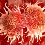 Young Cancer Risk: युवाओं व बच्चों में भी बढ़ रहा है कैंसर का खतरा? जानिए Gen Z और Millennials के लिए कैंसर क्यों होता जा रहा है खतरनाक