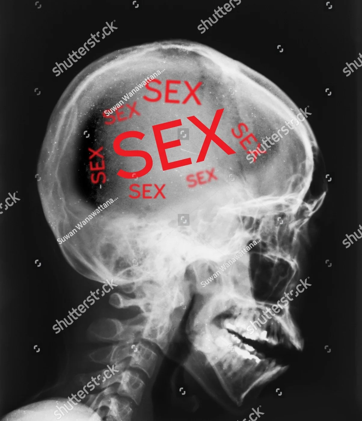 stock photo x ray of head isolated with word sex inside 689494732 (1)
