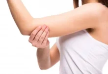 Skin Pigmentation file photo