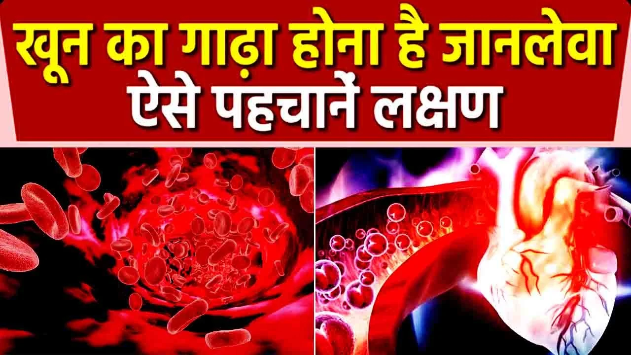 खून गाढ़ा होने के लक्षण और बचाव के उपाय